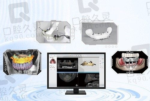许昌植得口腔种植牙价格6k-1.5w元，韩国/瑞士/瑞典等品牌任君挑选