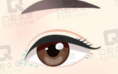 北京嘉禾李燕修复双眼皮怎么样?技术高超患者评价好均已被证实