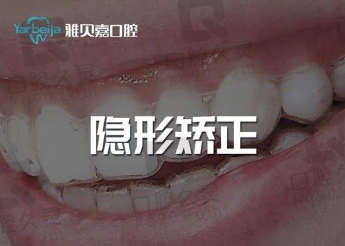 长春雅贝嘉口腔牙齿矫正价格展示：金属矫正9600+隐形矫正14800+