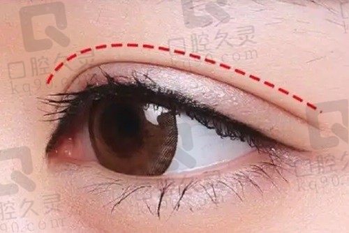 郑州东方贺洁院长简介:修复双眼皮技术好到爆 超受欢迎且无失败案例