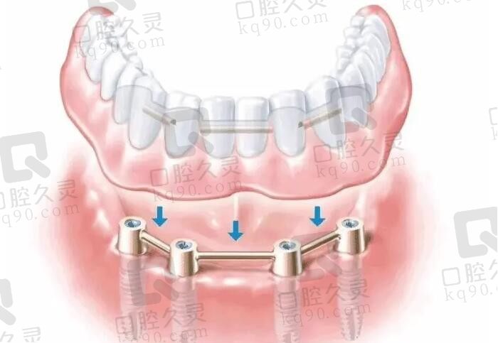 海南拜博口腔医院是私立还是公办？口碑评价如何？