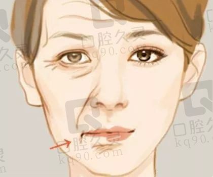 西安做拉皮好的医生有:王志军、张林宏等，汇总推荐医生及拉皮手术费用