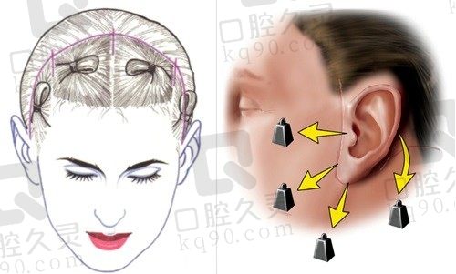 祝东升医生做面部拉皮口碑怎么样？好评不断,患者真实评价走一波