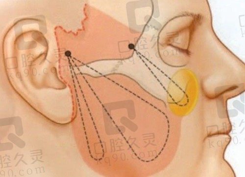 袁强博士在哪预约挂号？北京联合丽格，这有袁强博士怎么挂号全攻略