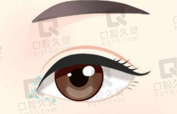 蔡灵双眼皮案例合集分享,整友评价技术超好!术后双眼皮自然好看