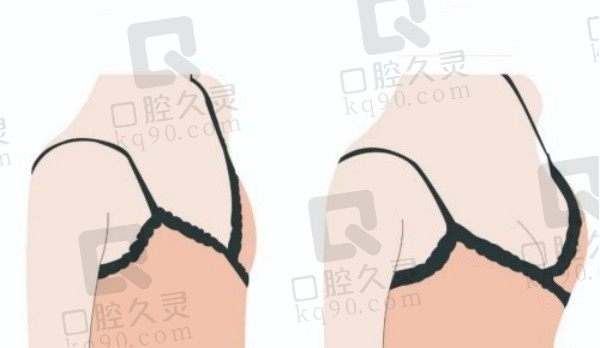 徐国建隆胸和谢卫国哪个经验丰富些?都是做胸多年的医生技术特色有区别