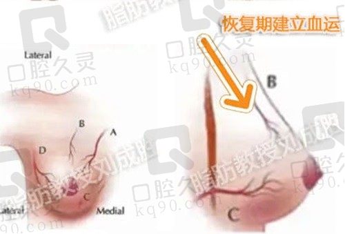 北京刘成胜脂肪隆胸怎么样？口碑评价显示刘成胜脂肪丰胸成活率高