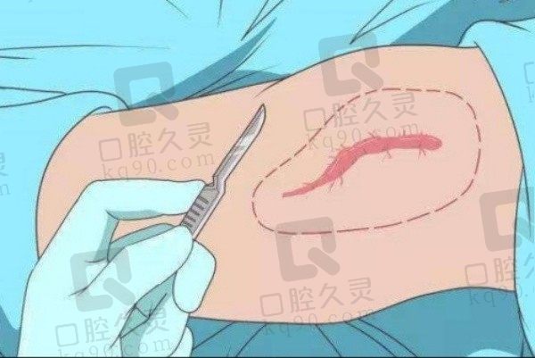 拉萨维多利亚艾长安手术祛疤2900元起，超精细缝合技术改善皮肤