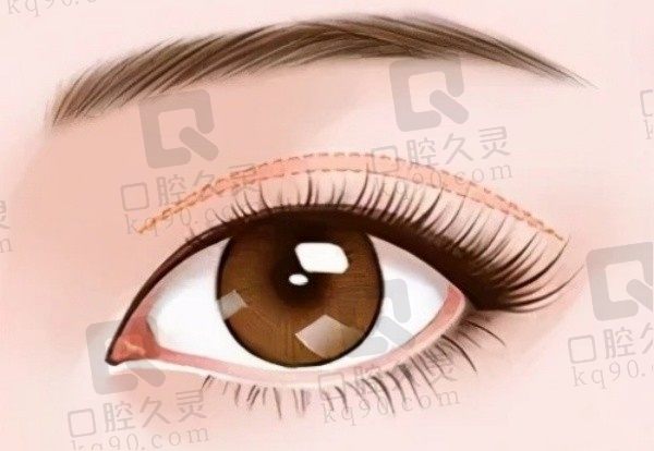 王衡健不在上海九院了,想预约王衡健做双眼皮去上海爱尚丽格挂号