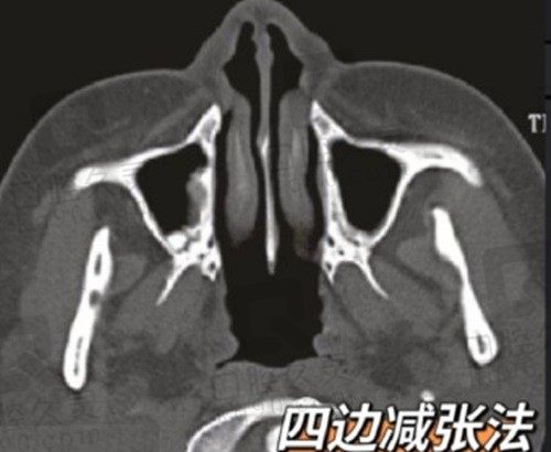 北京郑永生修复技术咋样？擅长眼/鼻/唇裂/耳畸形修复 实力杠杠的