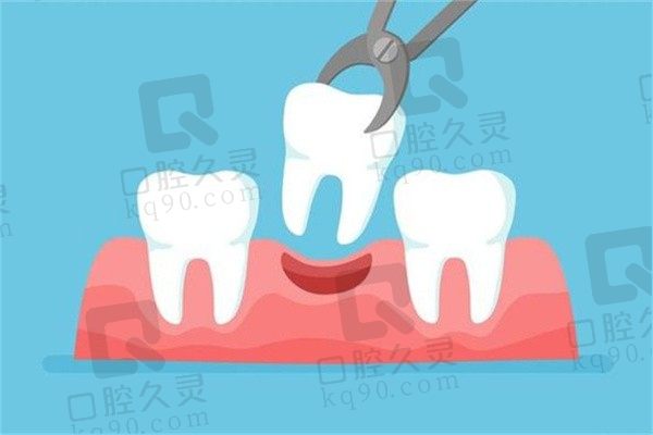 商丘口腔医院拔牙价格20元起一颗，拥有超声骨刀拔牙更微创