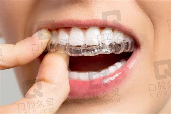 泉州海丝口腔龚博林国产隐形矫正12800起，轻松重塑畸形牙