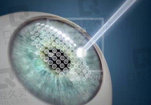 乐山爱尔眼科近视手术价格:飞秒1.5w-2.1w,晶体植入3.3w-3.7w