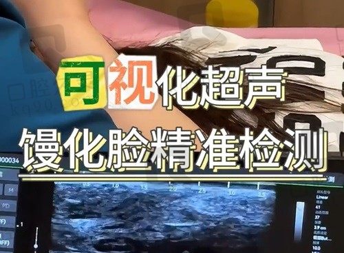 北京艺美免费做可视化超声馒化脸检测啦，馒化脸修复也只要32800元起