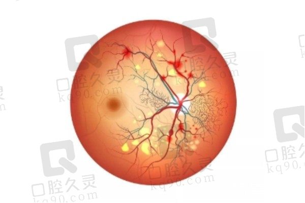 长春恒达眼科医院视网膜色素变性手术2.6万，彭秀芹院长亲诊