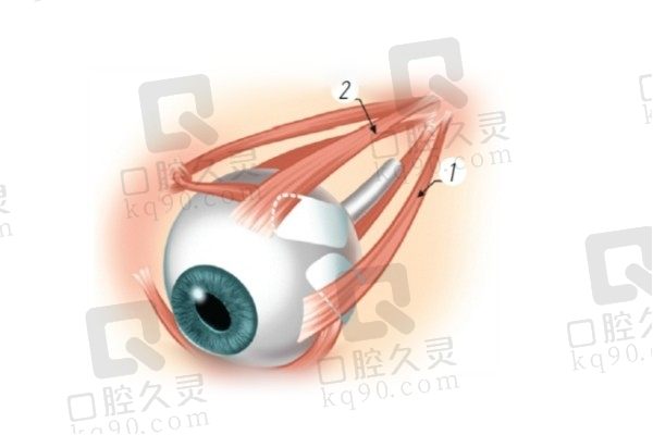上海和平眼科医院后巩膜加固术3.6万起，褚仁远教 授可预约