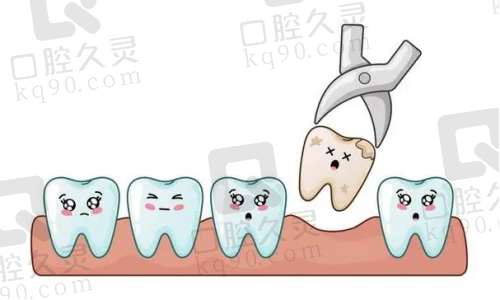 惠州致美口腔医院拔正位智齿368元起一颗，拔牙快速微创体验好