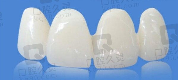 南阳植得口腔爱尔创全瓷牙修复1099元起，适合镶牙/根管治疗修复