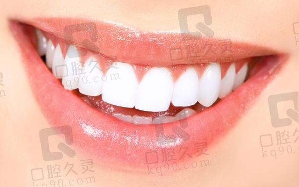 北京劲松口腔冷光美白2459元起，色泽美观自然逼真