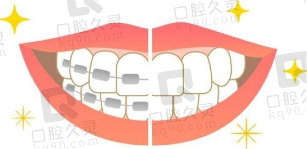 正畸徐宝华是不是真的很厉害？北京正畸圈对徐宝华的评价及收费一览