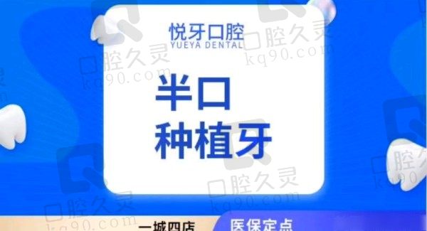 六安悦牙口腔叶长林半口种植牙价格35800元起，医术高明