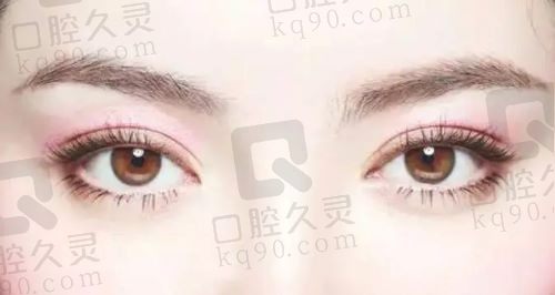 北京做双眼皮哪家医院最专业最好？做双眼皮排名靠前的医院都在这