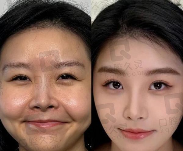 朱慧東饅化修復(fù)口碑怎么樣?顧客真實(shí)反饋+技術(shù)特點(diǎn)+收費(fèi)揭曉