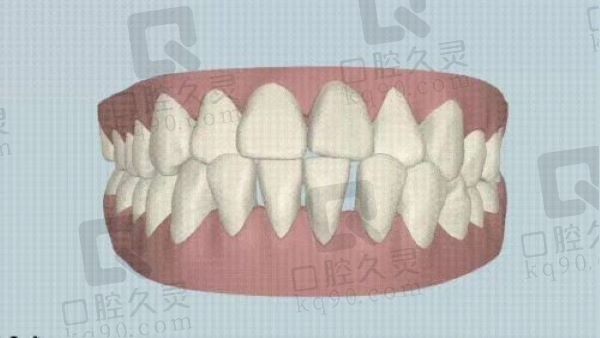 上海闵行区口腔便宜又好的牙科医院有哪些？鼎植/尤旦/虹桥/金贝齐口腔上榜！