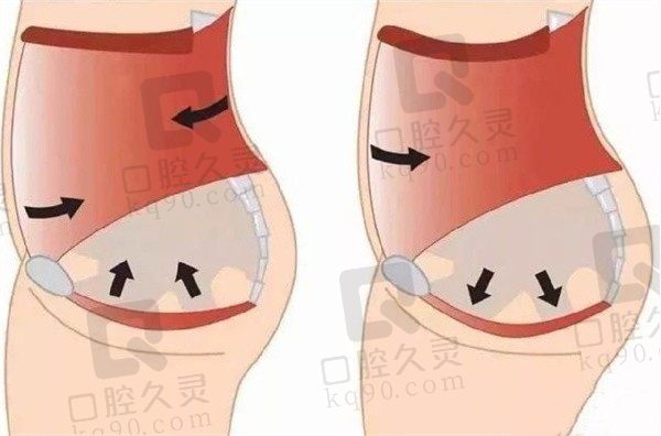 杭州3d生物束带紧缩术哪个医院好？2025杭州阴道紧缩医院排名前十，美莱/艺星/整形医院医生价格对比