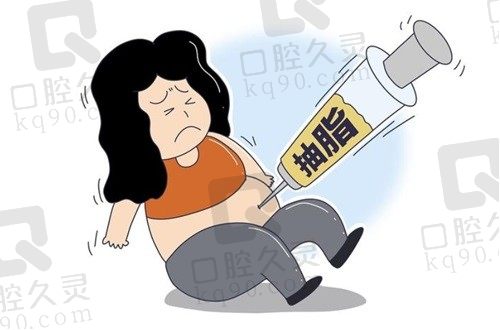 北京艺美腰腹吸脂88000起，王东院长亲诊创伤小术后皮肤平整光滑