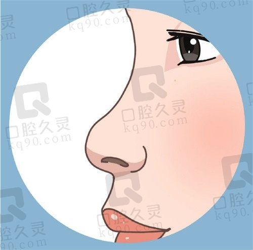 成都周柯鼻修复费用公开:肋软骨隆鼻6w+,挛缩鼻修复7w+,高难度鼻畸形修复8w+