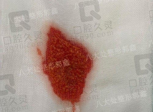 北京八大处取生长因子专家都有谁?郭鑫/赵延勇/岳颍医生值得信赖