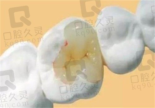 兴化三叶草口腔医院怎么样?是实力出色而且看牙价格不贵的正规牙科