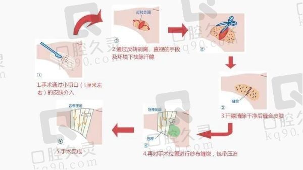 四川友谊医院腋臭科怎么样?资质正规/医生经验足/设备高端/评价好