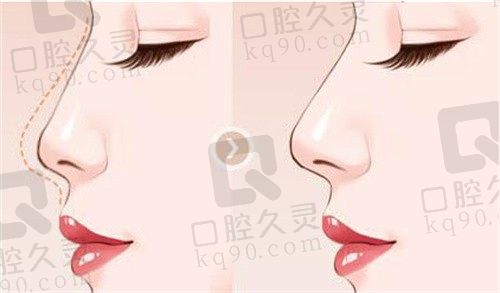 武汉邓裴不在同济吗?还在同济坐诊且邓裴做鼻子是正规不是仿可放心预约