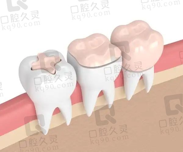 咿呀口腔价格表2025：含岳阳/黄石/襄阳/宜昌/恩施等咿呀口腔收费情况