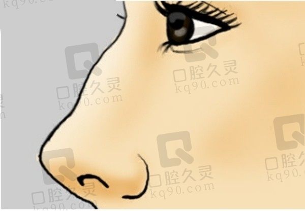 南京林金德鼻子怎么样？林金德鼻综合的口碑好案例多,在南京友谊任职