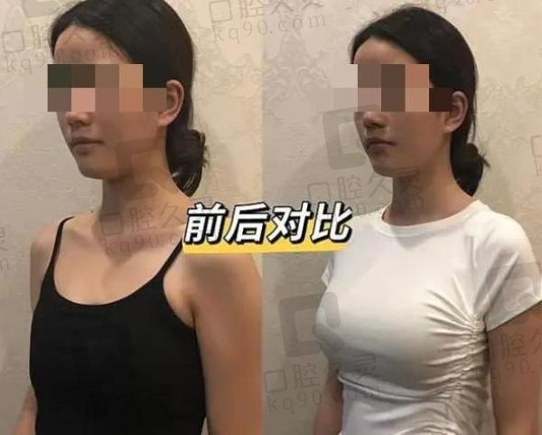 青岛诺德刘金华的技术怎么样？隆胸技术牛性价比高可在线预约挂号