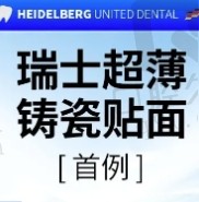 天津海德堡口腔医院瑞士进口牙贴面2800元起，超薄铸瓷贴面自然美观