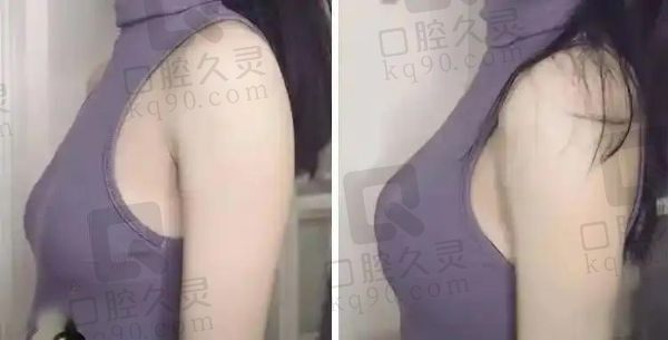 薛瑞医生做胸怎么样？风格自然手感逼真口碑与评价超好被称为丰胸王子