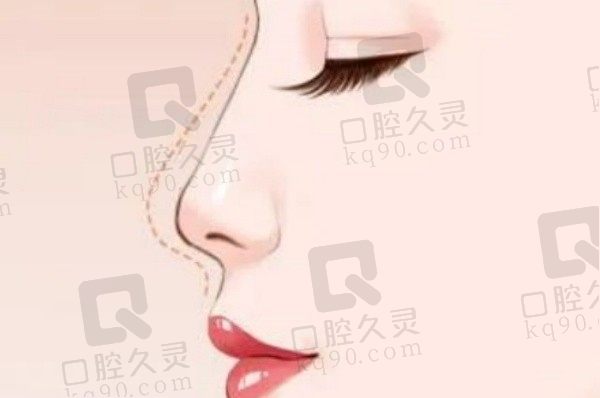上海时光瞿健鼻子怎么样？做鼻综合/鼻修复技术成熟尤其擅长自然妈生鼻
