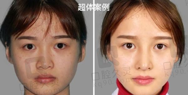 成都大象致颜医疗美容是渠道医院吗？不是,正规医院做鼻子很出名