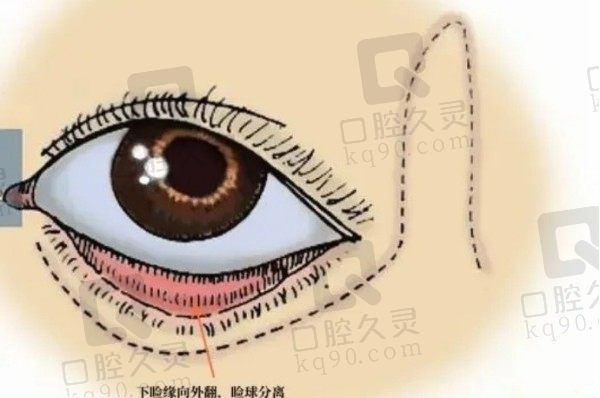 安徽维多利亚眼修复医生名单介绍：王明刚/吴丽丽/卫爱侠医生眼失败修复技术实力在线