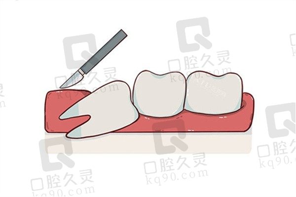 太原鼎植口腔拔智齿价格296元起一颗，仪器高端拔牙技术成熟