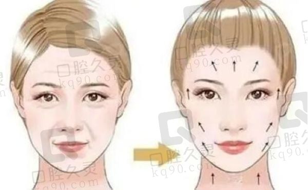 倪锋医生做拉皮怎么样？倪锋拉皮提升技术熟练成效明显价格不贵
