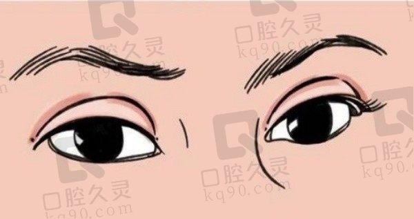 [沈国雄个人资料简介]原上海九院医生,双眼皮修复技术好口碑评价高