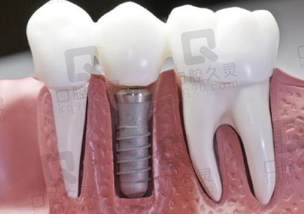 北京密云健福口腔医院是公立的吗？深度解析医院资质、技术与服务优势