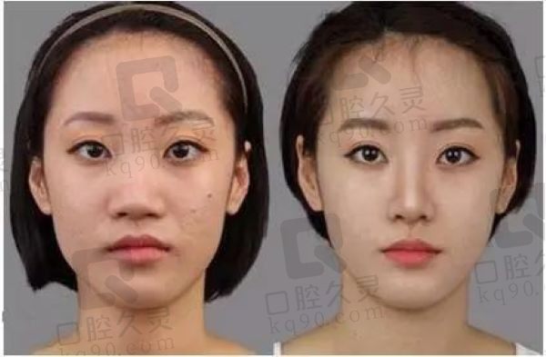 北京陈翠云医生是爱贝芙认证医生吗？是官方认证医生技术在线收费合理