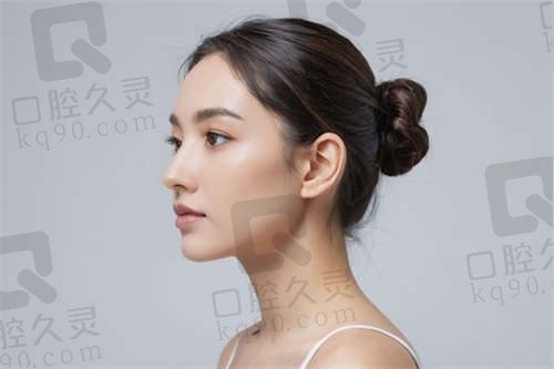 杭州时光医疗美容医院项昌峰医生技术一流，做的鼻修复术后效果如妈生，很自然