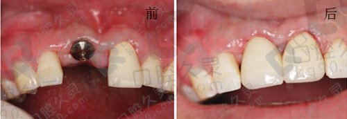福州便宜的牙科口腔诊所汇总,内附福州口腔医院牙科价目表!